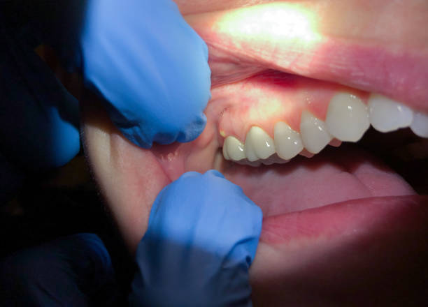 Best Mobile Emergency Dentist in Fortuna, CA