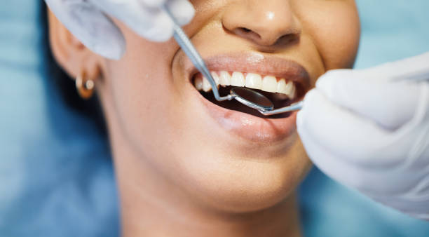 Best Holiday Emergency Dentist in Fortuna, CA