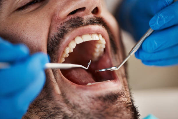 Best Broken or Cracked Tooth Emergency Dentist in Fortuna, CA