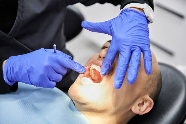 Best Emergency Dental Care for Abscessed Tooth in Fortuna, CA
